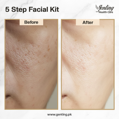5-step Whitening Facial kit (200ML)